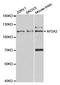 AP-2 complex subunit alpha-2 antibody, A5391, ABclonal Technology, Western Blot image 