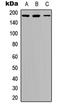 Insulin Receptor Substrate 1 antibody, GTX32400, GeneTex, Western Blot image 