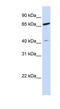 Zinc Finger Protein 334 antibody, NBP1-79707, Novus Biologicals, Western Blot image 