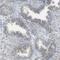 Zinc Finger Protein 516 antibody, HPA015792, Atlas Antibodies, Immunohistochemistry paraffin image 