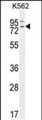 RAS Guanyl Releasing Protein 2 antibody, PA5-35111, Invitrogen Antibodies, Western Blot image 