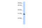 Ribonuclease A Family Member 9 (Inactive) antibody, 26-282, ProSci, Enzyme Linked Immunosorbent Assay image 