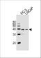 Vitamin D Receptor antibody, A00210, Boster Biological Technology, Western Blot image 
