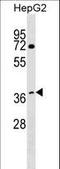 DDB1- and CUL4-associated factor 7 antibody, LS-C157370, Lifespan Biosciences, Western Blot image 