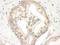 Janus Kinase 2 antibody, NBP1-22975, Novus Biologicals, Immunohistochemistry paraffin image 