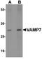 Vesicle Associated Membrane Protein 7 antibody, A03201, Boster Biological Technology, Western Blot image 