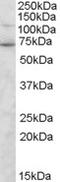 Syntrophin Gamma 2 antibody, TA305821, Origene, Western Blot image 