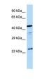 Arginine Vasopressin Receptor 1B antibody, orb331206, Biorbyt, Western Blot image 