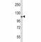 Eukaryotic Translation Initiation Factor 2 Alpha Kinase 3 antibody, F50992-0.4ML, NSJ Bioreagents, Western Blot image 