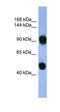 Adaptor Related Protein Complex 1 Subunit Beta 1 antibody, orb331076, Biorbyt, Western Blot image 