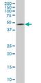 Ectodermal-Neural Cortex 1 antibody, H00008507-M03, Novus Biologicals, Western Blot image 