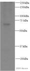 SRC Proto-Oncogene, Non-Receptor Tyrosine Kinase antibody, ab16885, Abcam, Western Blot image 