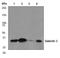 Galectin 3 antibody, ab76245, Abcam, Western Blot image 