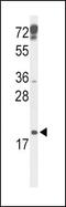 Cyclin Dependent Kinase Inhibitor 2D antibody, PA5-26413, Invitrogen Antibodies, Western Blot image 