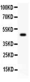 C-Terminal Src Kinase antibody, PA5-79076, Invitrogen Antibodies, Western Blot image 