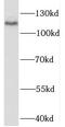 RNA Binding Motif Protein 25 antibody, FNab07171, FineTest, Western Blot image 