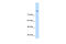 Discs Large MAGUK Scaffold Protein 2 antibody, 29-898, ProSci, Western Blot image 