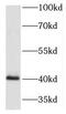 Homeobox A9 antibody, FNab03975, FineTest, Western Blot image 