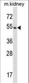 Fyn Related Src Family Tyrosine Kinase antibody, LS-C164390, Lifespan Biosciences, Western Blot image 