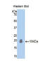 Activin A Receptor Type 2B antibody, LS-C292634, Lifespan Biosciences, Western Blot image 