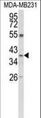 Arginase 1 antibody, LS-C156458, Lifespan Biosciences, Western Blot image 