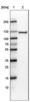 Poly(ADP-Ribose) Polymerase 1 antibody, AMAb90960, Atlas Antibodies, Western Blot image 