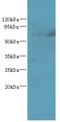 Tetratricopeptide Repeat Domain 30B antibody, A61586-100, Epigentek, Western Blot image 