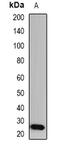 Glutathione S-transferase A1 antibody, abx225204, Abbexa, Western Blot image 