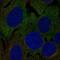Leucine-rich repeat-containing protein 4C antibody, NBP2-58242, Novus Biologicals, Immunofluorescence image 