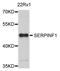Serpin Family F Member 1 antibody, LS-C331628, Lifespan Biosciences, Western Blot image 