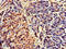 CCAAT Enhancer Binding Protein Alpha antibody, CSB-PA005180HA01HU, Cusabio, Immunohistochemistry paraffin image 