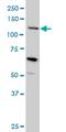 Mucin 4, Cell Surface Associated antibody, MCA3269Z, Bio-Rad (formerly AbD Serotec) , Immunohistochemistry paraffin image 