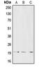 CD3d Molecule antibody, MBS821591, MyBioSource, Western Blot image 