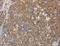 Actinin Alpha 4 antibody, LS-C404706, Lifespan Biosciences, Immunohistochemistry paraffin image 