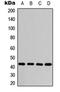 Protein Kinase CAMP-Activated Catalytic Subunit Alpha antibody, orb315659, Biorbyt, Western Blot image 