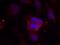 Protein Phosphatase 1 Regulatory Inhibitor Subunit 1B antibody, GTX50232, GeneTex, Immunofluorescence image 