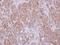 G Protein Subunit Alpha 15 antibody, GTX118385, GeneTex, Immunohistochemistry paraffin image 