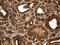 Thyroglobulin antibody, UM800159CF, Origene, Immunohistochemistry paraffin image 