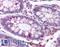 Polo Like Kinase 1 antibody, LS-B1675, Lifespan Biosciences, Immunohistochemistry frozen image 
