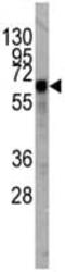 Kruppel Like Factor 4 antibody, ab75486, Abcam, Western Blot image 