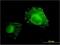 Amine Oxidase Copper Containing 3 antibody, H00008639-M06, Novus Biologicals, Immunofluorescence image 