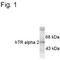 Thyroid Hormone Receptor Alpha antibody, MA1-4676, Invitrogen Antibodies, Western Blot image 