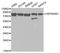 Heat Shock Protein 90 Alpha Family Class B Member 1 antibody, A1087, ABclonal Technology, Western Blot image 