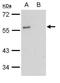 G Protein-Coupled Estrogen Receptor 1 antibody, PA5-28647, Invitrogen Antibodies, Western Blot image 