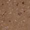 CD200 Molecule antibody, NBP1-87738, Novus Biologicals, Immunohistochemistry frozen image 