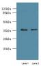 Phospholipid Phosphatase 2 antibody, LS-C376365, Lifespan Biosciences, Western Blot image 