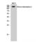 Histone Deacetylase 6 antibody, LS-C383937, Lifespan Biosciences, Western Blot image 