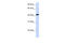 Src Kinase Associated Phosphoprotein 1 antibody, 26-097, ProSci, Enzyme Linked Immunosorbent Assay image 