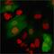 S100 Calcium Binding Protein A4 antibody, GTX02703, GeneTex, Immunofluorescence image 