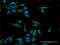 Inositol Polyphosphate-5-Phosphatase B antibody, H00003633-D01P, Novus Biologicals, Immunocytochemistry image 